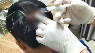 Patnáctiletý chlapec měl při rybaření nabodnuté na temeno hlavy tři rybářské háčky.