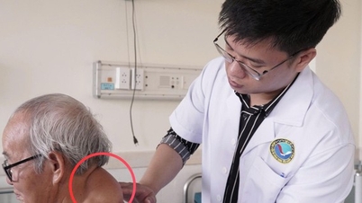بعد أن عانى رجل يبلغ من العمر 72 عامًا من ورم لأكثر من 40 عامًا، خضع لعملية جراحية ناجحة.