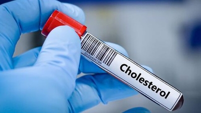 5 effective non-drug methods to control high cholesterol.