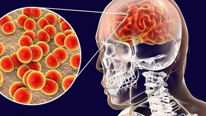 Ca Mau: Epidemie meningokokové meningitidy ve věznici Cai Tau byla pod kontrolou a ukončena.