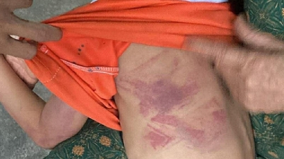 দ্বিতীয় শ্রেণির এক ছাত্রীকে তার সহপাঠীরা ছুটির সময় মারধর করে আঘাত করেছে।