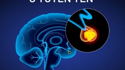 Medical news update April 23rd: Unusual height increase in middle age, rare pituitary tumor discovered.