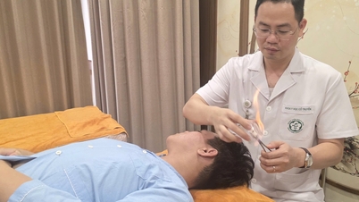Riesgo de parálisis facial en climas cálidos y húmedos.