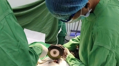 Un homme a failli subir une amputation du pénis après que celui-ci ait été comprimé par deux écrous métalliques.