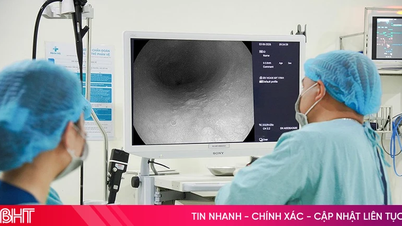 In un paziente di 50 anni sono state individuate lesioni precancerose dell'esofago esclusivamente grazie a eruttazioni persistenti.
