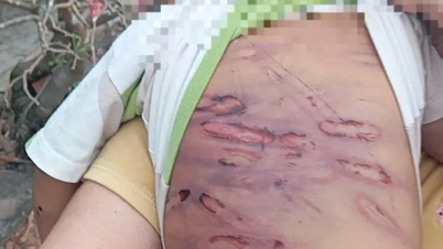 Proposta per una struttura di assistenza sociale destinata ad accogliere un bambino di 2 anni vittima di abusi.