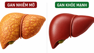 Vitamin yang biasa ditemui boleh menjadi 'penyelamat' untuk penyakit hati berlemak.