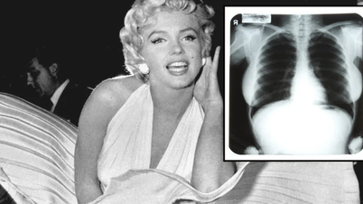 Marilyn Monroe's X-ray image sparks outrage after being auctioned off.