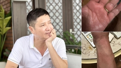 NSƯT Chí Trung mắc bệnh lạ, mất ngủ triền miên