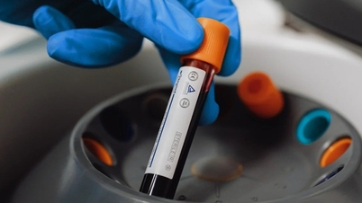 Se detectaron "sustancias químicas permanentes" en el 98,8% de las muestras de sangre analizadas.