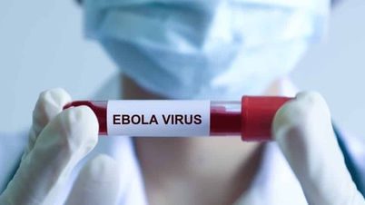 Kementerian Kesihatan menasihati orang ramai untuk mencegah Ebola secara proaktif selepas amaran daripada WHO.