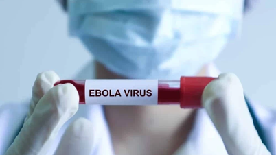 Kementerian Kesehatan merekomendasikan langkah-langkah pencegahan Ebola dalam konteks epidemi kompleks pada tahun 2026.