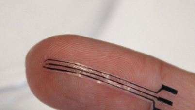 Un dispositivo de impresión 3D procedente de Estados Unidos ayuda a reducir la presión arterial de forma eficaz.