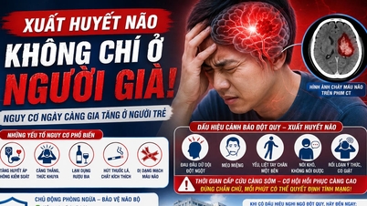 Perdarahan otak pada anak muda: Jangan anggap enteng!