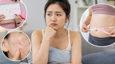 من السهل التغاضي عن علامات متلازمة تكيس المبايض.