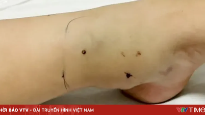 Mùa rắn sinh sản, nguy cơ rắn độc cắn gia tăng