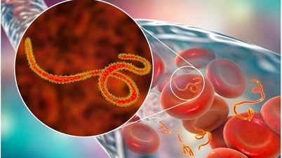 Ebola 130'dan fazla kişinin ölümüne neden oldu, DSÖ salgının kontrolden çıkmasından endişe ediyor.