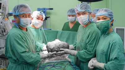 İç organlara sıkıca yapışmış 5 kilogramlık bir tümörü çıkarmak için gergin bir ameliyat gerçekleştirildi.