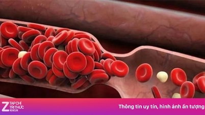 Tiny molecules help you avoid heart attacks.