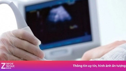 7월 1일부터 137가지 질병 검사를 통해 태아의 성별을 알 수 있게 됩니다.