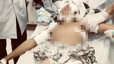 В результате очередного нападения собаки 11-летний мальчик попал в больницу.