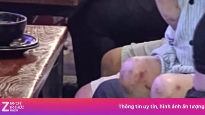 La policía investiga denuncias de abuso contra una niña de 3 años en un bar.