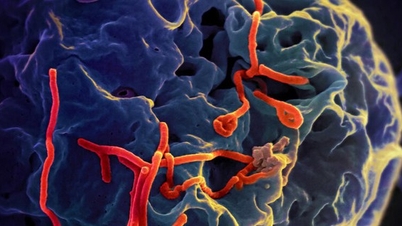 The Ministry of Health reports on the complex developments of the Ebola virus outbreak.