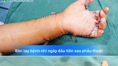 Seorang anak berusia 7 tahun hampir kehilangan tangannya karena alat buatan sendiri, hal ini menjadi peringatan bagi banyak keluarga.