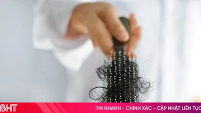 Why do I experience excessive hair loss?