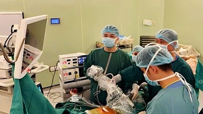Mit einem einzigen chirurgischen Schnitt werden gleichzeitig Luftzysten in beiden Lungen behandelt.