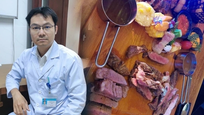 3 abitudini che aumentano il rischio di cancro al colon nei giovani.