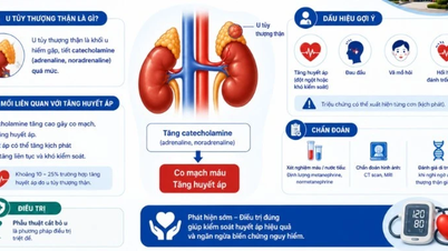U tủy thượng thận gây tăng huyết áp, đột quỵ, nhồi máu cơ tim