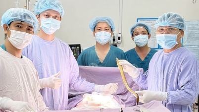 Vzácný případ: Operace odstraňuje úhoře, který propíchl konečník mužského pacienta.