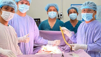 Des médecins ont retiré chirurgicalement une anguille de plus de 50 cm de long de l'estomac d'un patient de sexe masculin.