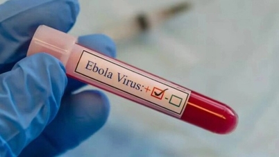 Ebola'ya karşı önleme tedbirleri güçlendirilmeli ve son 21 gün içinde salgın görülen ülkelerden gelen vakalara dikkat edilmelidir.