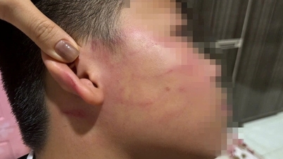 家庭教師が小学4年生の生徒を殴打し、生徒の顔に痣を残したとされる件について、情報の確認を行っている。