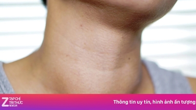 体の部位が腫れるほど、健康リスクは深刻になる。