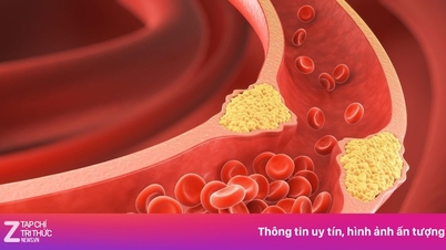 5 tanda peringatan bahwa darah Anda terlalu kental.