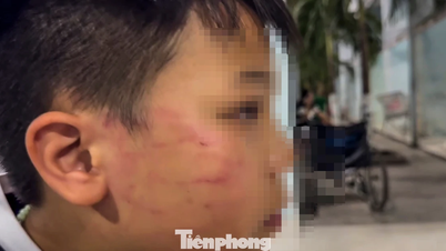 Проводится проверка обстоятельств инцидента, когда иностранный учитель ударил по лицу 9-летнего мальчика.