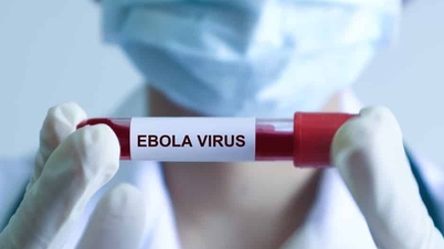 Kadar kematian akibat Ebola boleh mencecah 90%, Kementerian Kesihatan menggariskan simptom-simptom biasa penyakit ini.