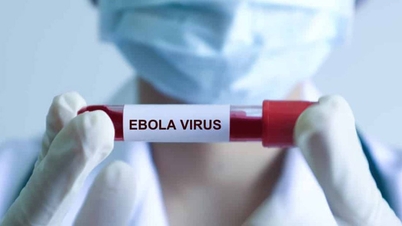 Śmiertelność z powodu wirusa Ebola sięga 90%; Ministerstwo Zdrowia wydało pilne zarządzenie nakazujące ścisłą izolację.