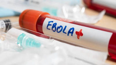 Diretrizes para o diagnóstico e tratamento do Ebola