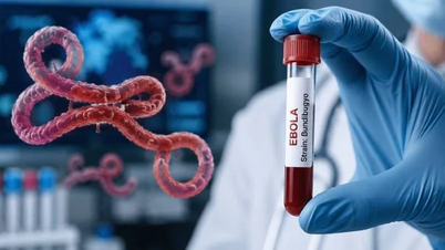 Il Ministero della Salute attiva la sorveglianza dell'Ebola e rafforza le misure per impedire l'ingresso della malattia nel Paese.