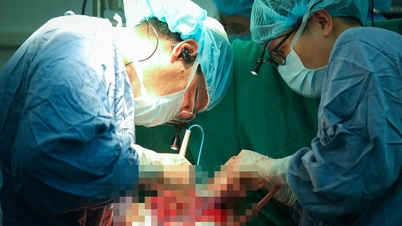La svolta nel campo dei trapianti d'organo: 21 pazienti hanno ricevuto una nuova possibilità di vita in una settimana.