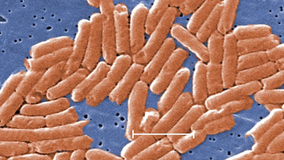 Il cambiamento climatico sta aumentando la resistenza globale agli antibiotici.