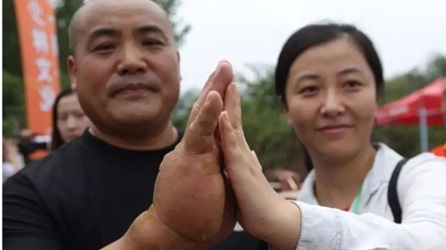 Il maestro di arti marziali cinesi Jin Yong pratica da 20 anni la sua arte marziale; ora le sue mani hanno uno spessore di 8 cm.