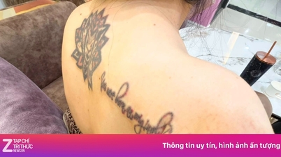 Die TikTokerin Vo Ha Linh gab 45 Millionen VND für 11 Tattooentfernungssitzungen aus.