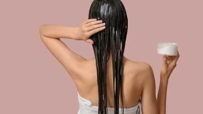 'The more you wash, the more dandruff you get': The surprising truth behind constantly itchy hair