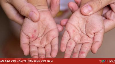 Ho Chi Minh-byen: Tilfeller av denguefeber synker, tilfeller av hånd-, fot- og munnsyke er fortsatt høye.