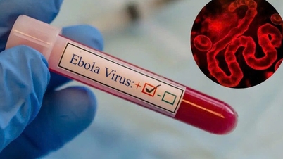 Dịch bệnh Ebola diễn biến phức tạp tại Châu Phi nhưng người dân không nên hoang mang